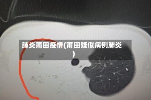 肺炎莆田疫情(莆田疑似病例肺炎)