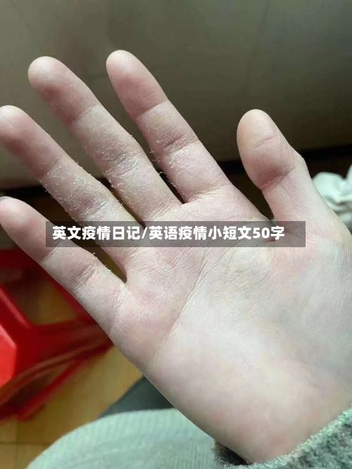 英文疫情日记/英语疫情小短文50字-第2张图片
